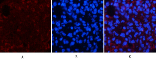 A41001, 41001, β-actin,beta actin,β actin,beta-actin,actin,ACTIN