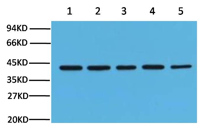 A41004, 41004, β-actin,beta actin,β actin,beta-actin,actin,ACTIN