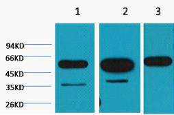 A41018, 41018, β-tubulin,beta-Tubulin,beta Tubulin,Tubulin,β Tubulin,tubulin,TUBULIN