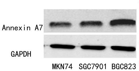 A41023, 41023, GAPDH mouse mAb(PT0325),GAPDH,gapdh